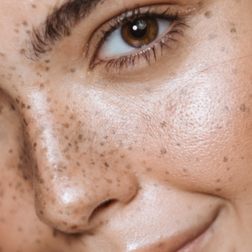 Seasonal Changes & The Ingredients Your Skin is Craving
